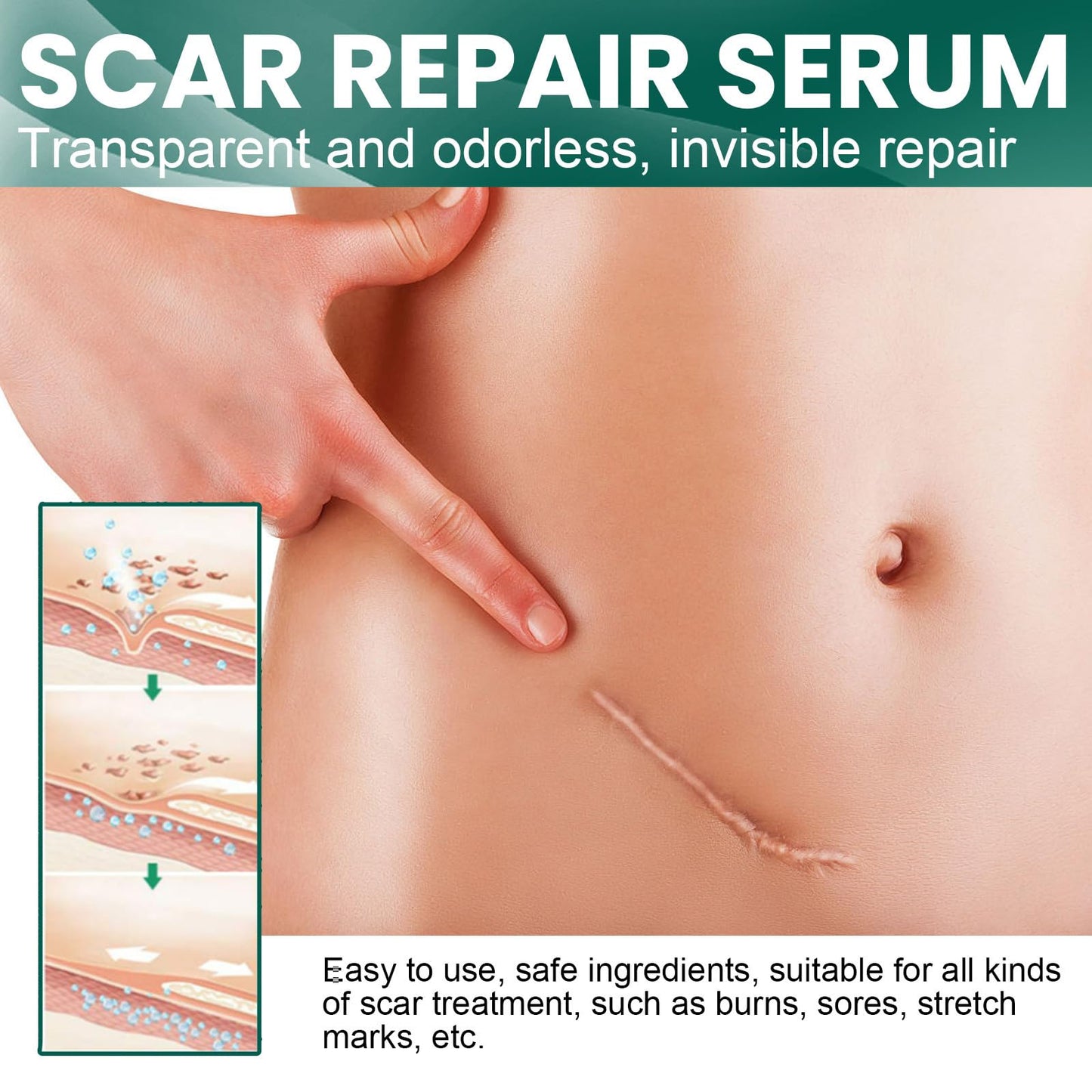 ewku Scar Removal Set with Repair Scar Cream & Serum, Stretch Mark Removal Cream for Old and New Marks, Acne Scar Treatment for Body, Trauma Scars, Scald, Hyperpigmentation & All Types of Scars