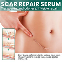ewku Scar Removal Set with Repair Scar Cream & Serum, Stretch Mark Removal Cream for Old and New Marks, Acne Scar Treatment for Body, Trauma Scars, Scald, Hyperpigmentation & All Types of Scars
