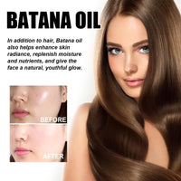 ChicNana Batana Oil, Batana Oil For Hair Growth, Hair Growth Oil, Batana Oil Organic, Strengthening And Thickening Hair, Repair Damaged Hair, Nourishes Scalp, Natural Hair Growth Oil 60ml