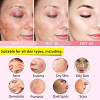 Buyourtaste Kojic Acid and Turmeric Pads 50Pcs, Turmeric Kojic Acid Cleaning Pads, Turmeric Face Pad, Turmeric Exfoliating Foaming Pads, Facial Sponges for Cleansing, Fade Acne, Dark Spots, Hyperpigmentation (1)