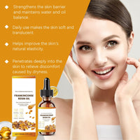 SingHao Frankincense Resin Oil,Moisturizing Frankincense Oil,Frankincen/se Resin Infused Oi/l for Face,Natural Anti-Aging Serum,Fra/nkincense O/il for Skin Care,Rapid Absorption Frankin/cense Re/sin O/il