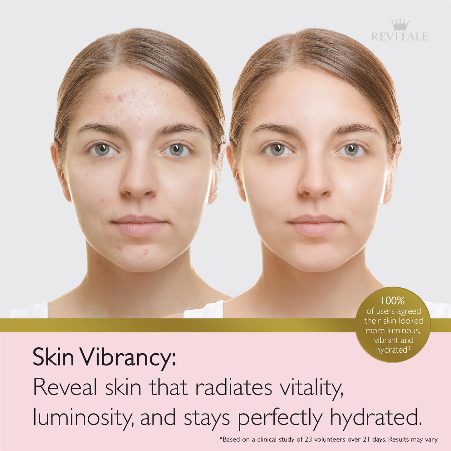 Revitale Advanced Salicylic Acid Cream for Face & Body 80g – Helps Smooth & Soften Skin Texture. For Rough, Bumpy & Blemish-Prone Skin