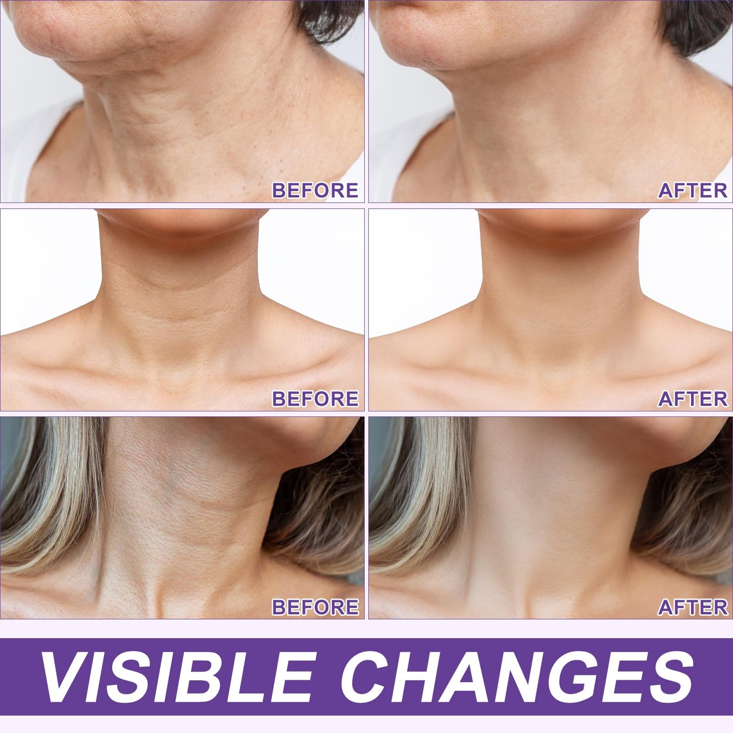 Dvoevivh Neck Firming Cream Tighten And Lift Neck Cream Ah-8 Firming Neck Cream Contain Hexapeptide With Double Roller Massage Reduce Wrinkles Fine Lines And Double Chin Firm And Lift Sagging Skin 120g