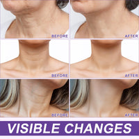 Dvoevivh Neck Firming Cream Tighten And Lift Neck Cream Ah-8 Firming Neck Cream Contain Hexapeptide With Double Roller Massage Reduce Wrinkles Fine Lines And Double Chin Firm And Lift Sagging Skin 120g