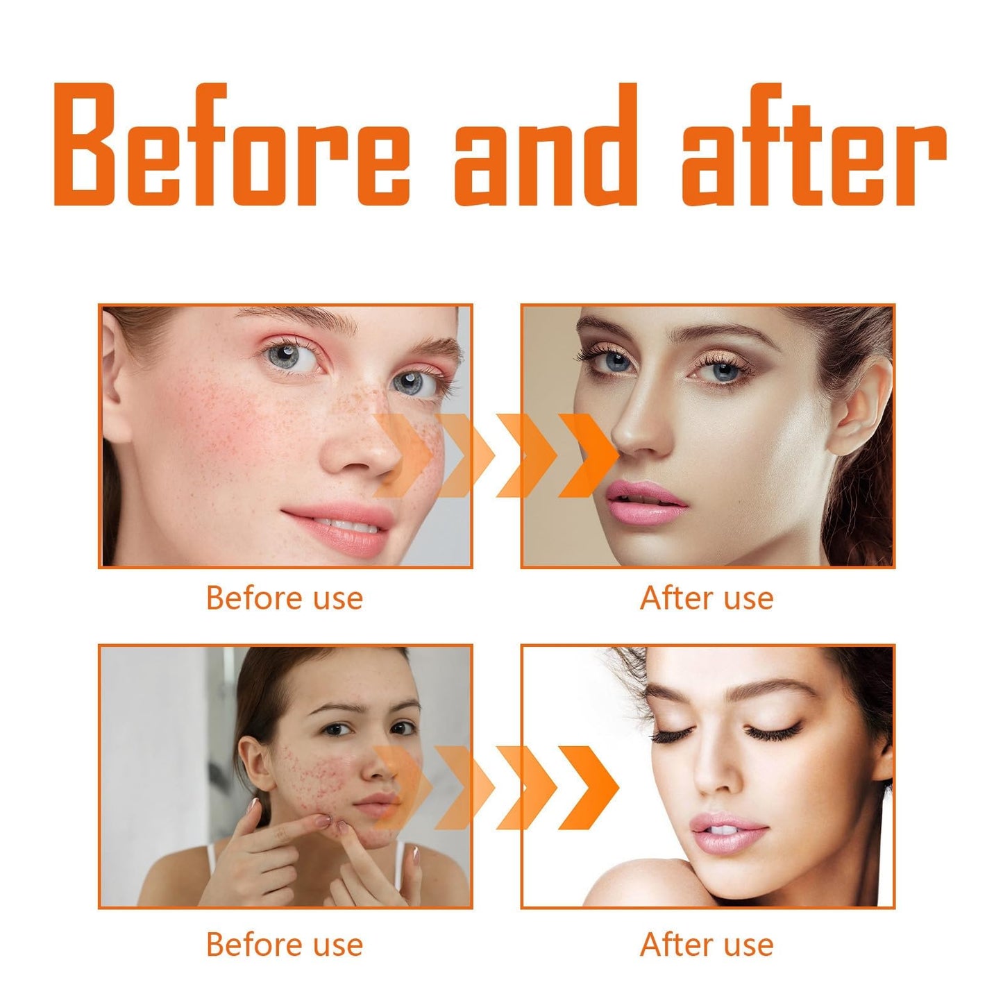 Face Toner - Turmeric Toner for Face - Face Care for Hydrating,Repairing,Anti-Aging - Natural Turmeric Essence Skincare Toner - Moisturizing,Soothing,Brightening Facial Toner