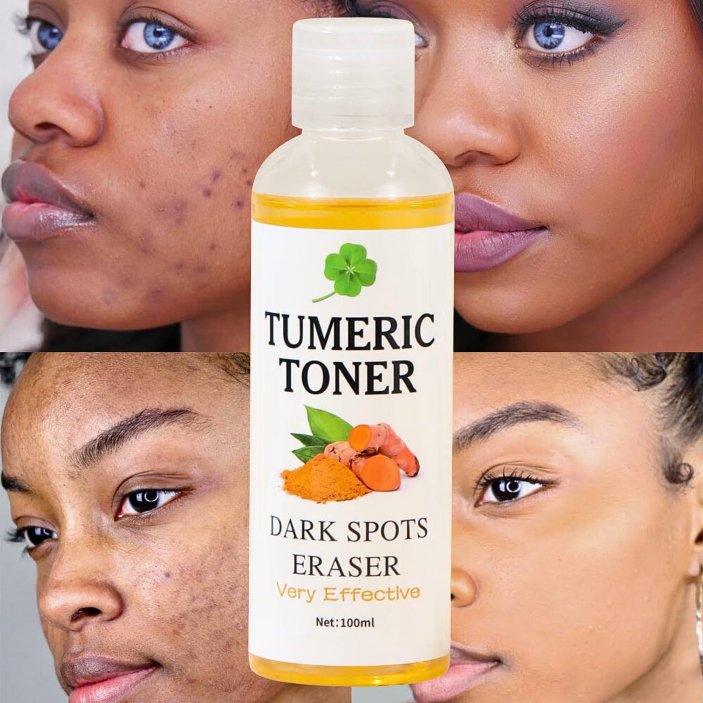 IZBEAUVO Turmeric Face Toner, Dark Spots Skin Toner for Face, Pore Minimizer Hydrating Toner, Face Exfoliator, Clean and Clear Facial Toner for Reduce Dark Spots & Acne, Brighten, Turmeric Oil Moisturiser