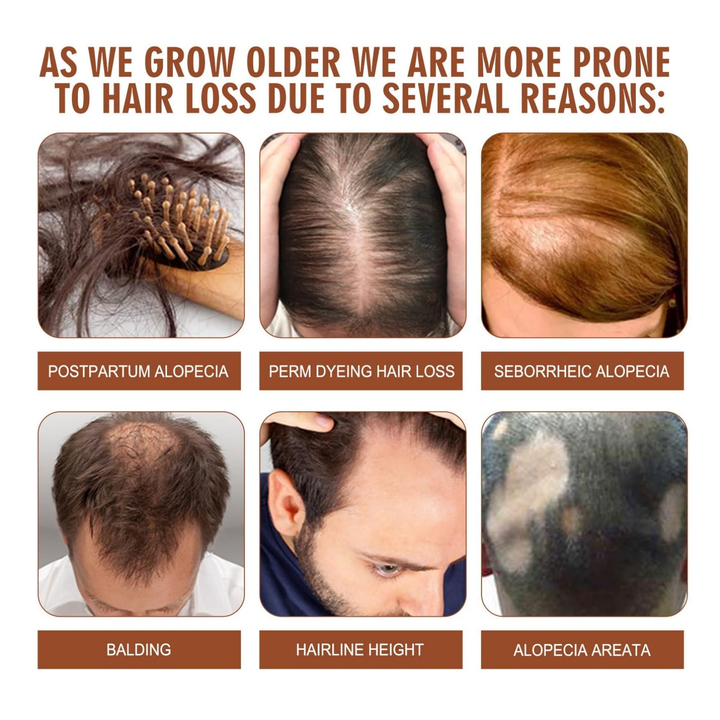 SingHao 100G Ba/tana Oil for Hair Growth,Ba/tana Hair Growth Oil,Raw Batan/a O/il Organic Bat/ana Hair Gro/wth Butter,Hair Thickening Products for Women,Hair Serum for Dry Damaged Ha/ir,Raw Bata/na O/il Paste