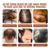 SingHao 100G Ba/tana Oil for Hair Growth,Ba/tana Hair Growth Oil,Raw Batan/a O/il Organic Bat/ana Hair Gro/wth Butter,Hair Thickening Products for Women,Hair Serum for Dry Damaged Ha/ir,Raw Bata/na O/il Paste