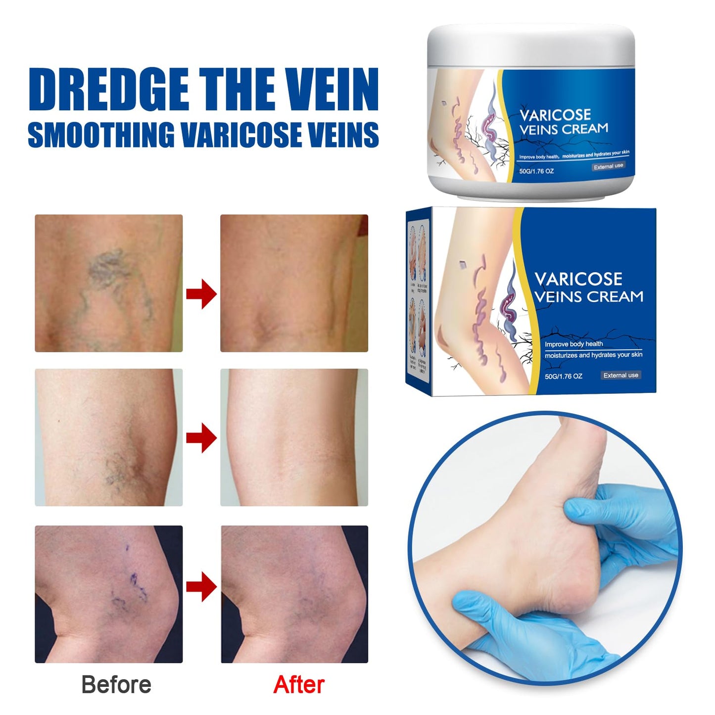 Boxiatil Leg Care Balm