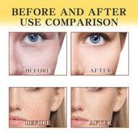 Jinjiar 2PCS Bee Venom Anti-Wrinkle Cream,Bee Venom Wrinkle Removal Cream for Face,Face Cream for Women,Face Cream for Dry Skin,Moisturiser Face Women,Skin Repair Cr-eam,Fa-ce Tightening Cre-am,Skin Cr-eam