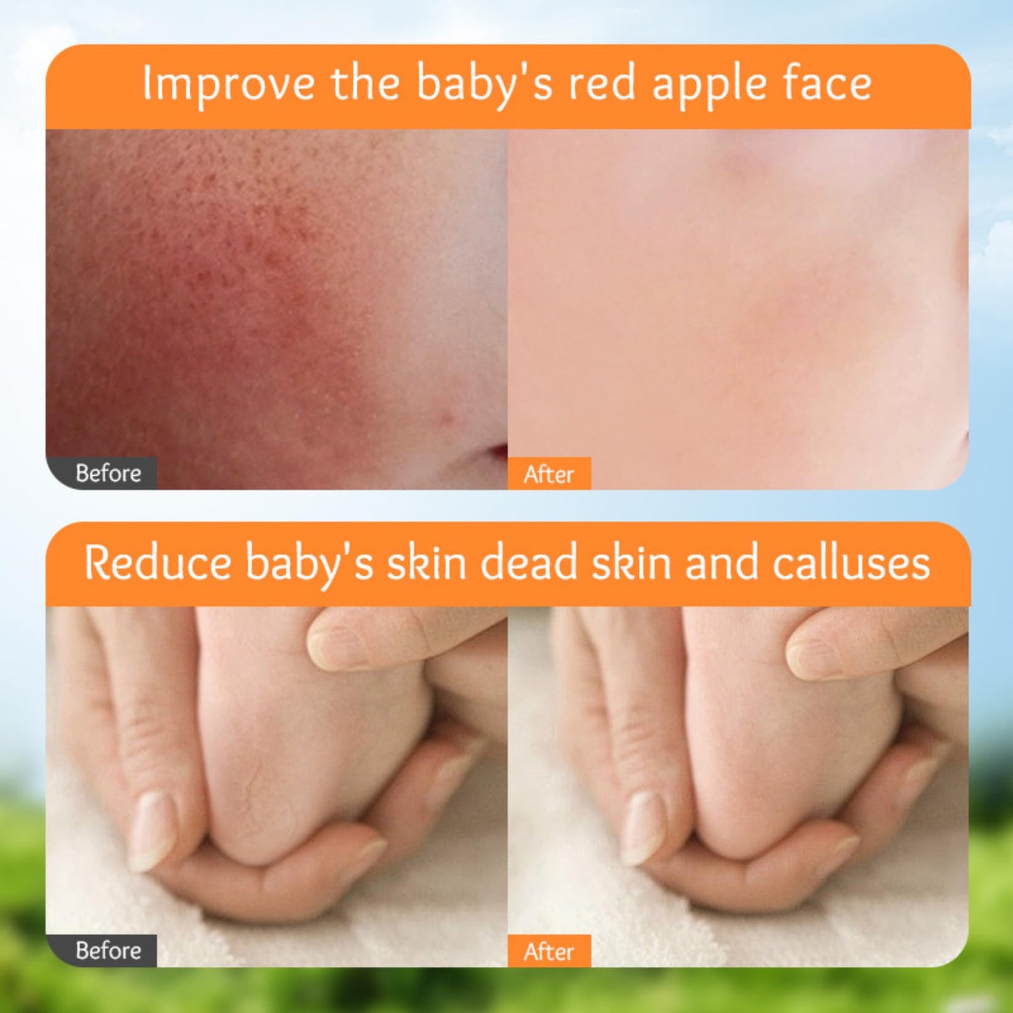 ISBEAUSOLS Baby Calendula Cream - Baby Moisturiser - Baby Cream Anti Cracking - Baby Lotion With 95% Calendula Extract & Vitamin E Soothing Skin - Baby Face Cream Gentle Protection Face&Body 50g