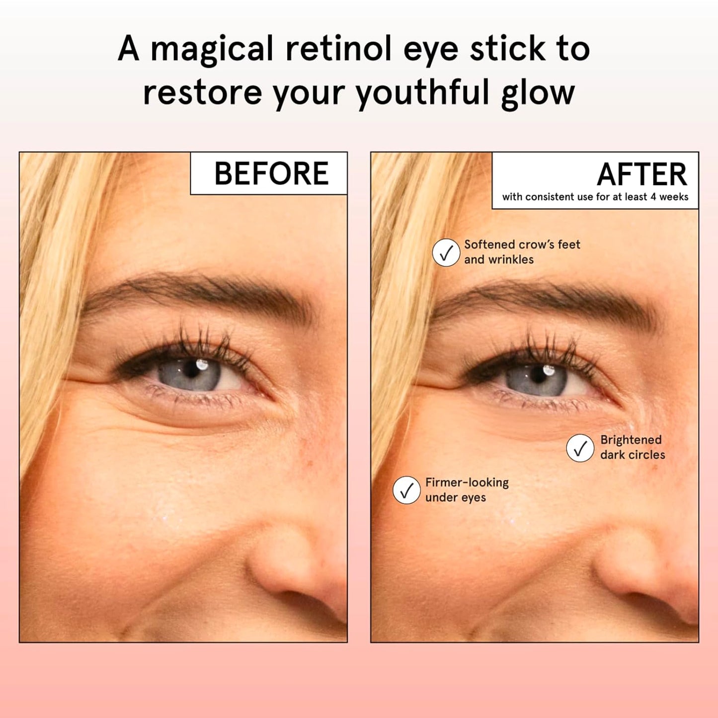 Under Eye Brightener Balm Stick - Retinol & Caffeine Eye Cream For Dark Circles And Puffy Eyes, Wrinkles, Eye Bags Remover Women - Instantly Hydrate And Brighten Under Eye Cream - Vegan Skincare