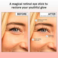 Under Eye Brightener Balm Stick - Retinol & Caffeine Eye Cream For Dark Circles And Puffy Eyes, Wrinkles, Eye Bags Remover Women - Instantly Hydrate And Brighten Under Eye Cream - Vegan Skincare