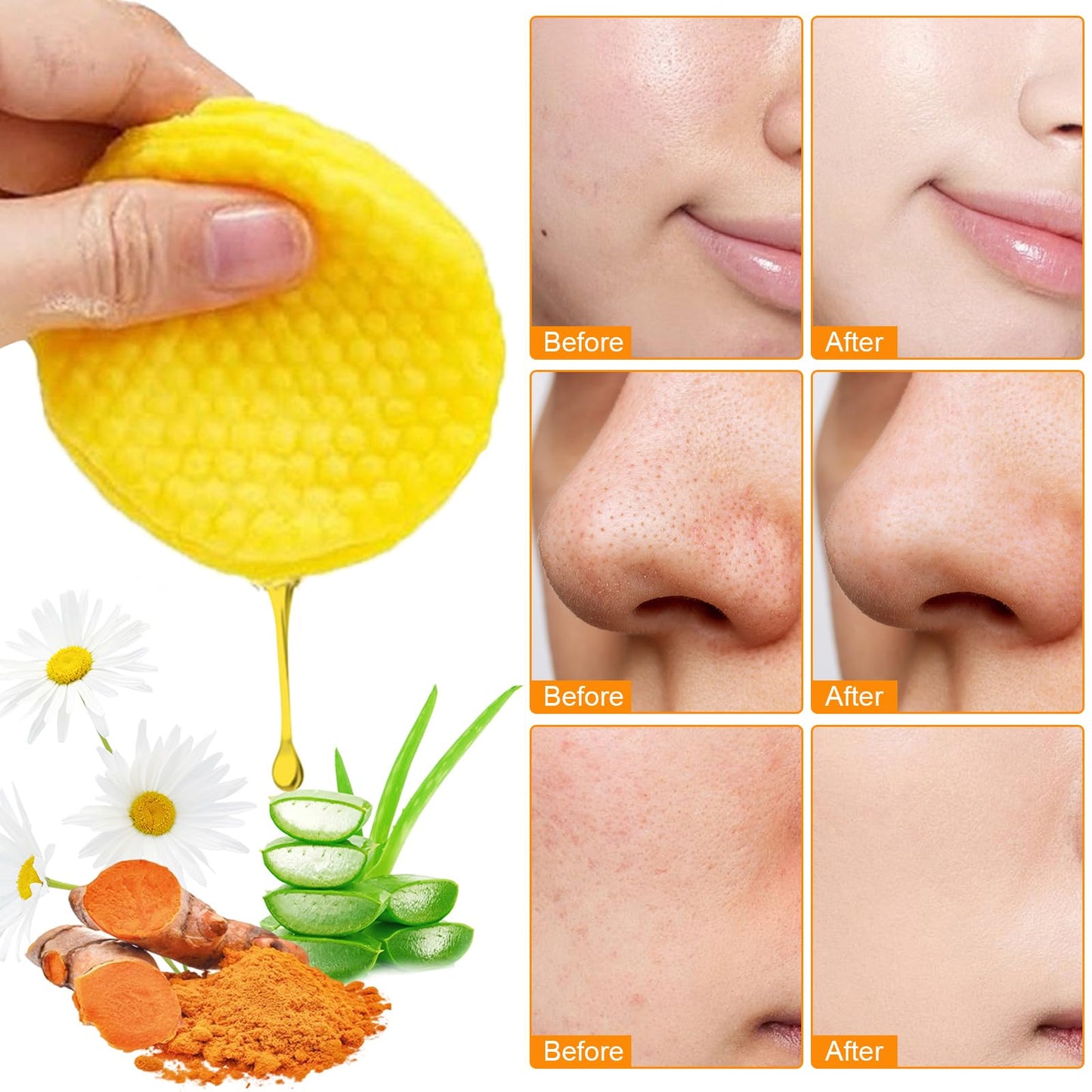 Ceboic Kojic Acid and Turmeric Pads, Turmeric Exfoliating Pads for Face, Turmeric and Kojic Acid Cleansing Pads Facial Sponges for Dark Spots, Acne Scars, Unclog Pores (50 Pads)