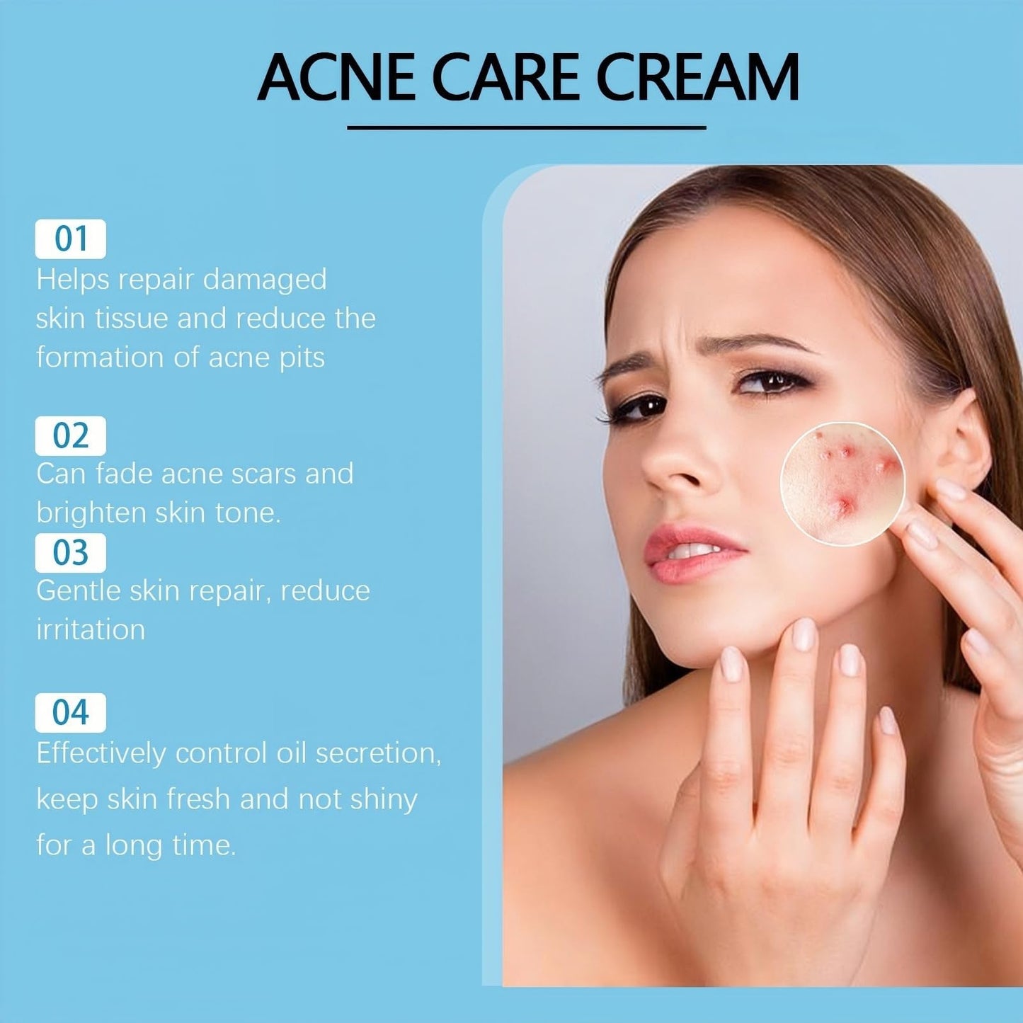 Xunzhi Acne Control Cream for Face,Acne Treatment Gel,A-cne Treatment,A-cne Face Cream,Ac-ne Gel Fast Absorbing Spot T-reatment,Anti Ac-ne F-ace C-ream,Acn-e C-ream for F-ace,Fa-ce Acn-e T-reatment