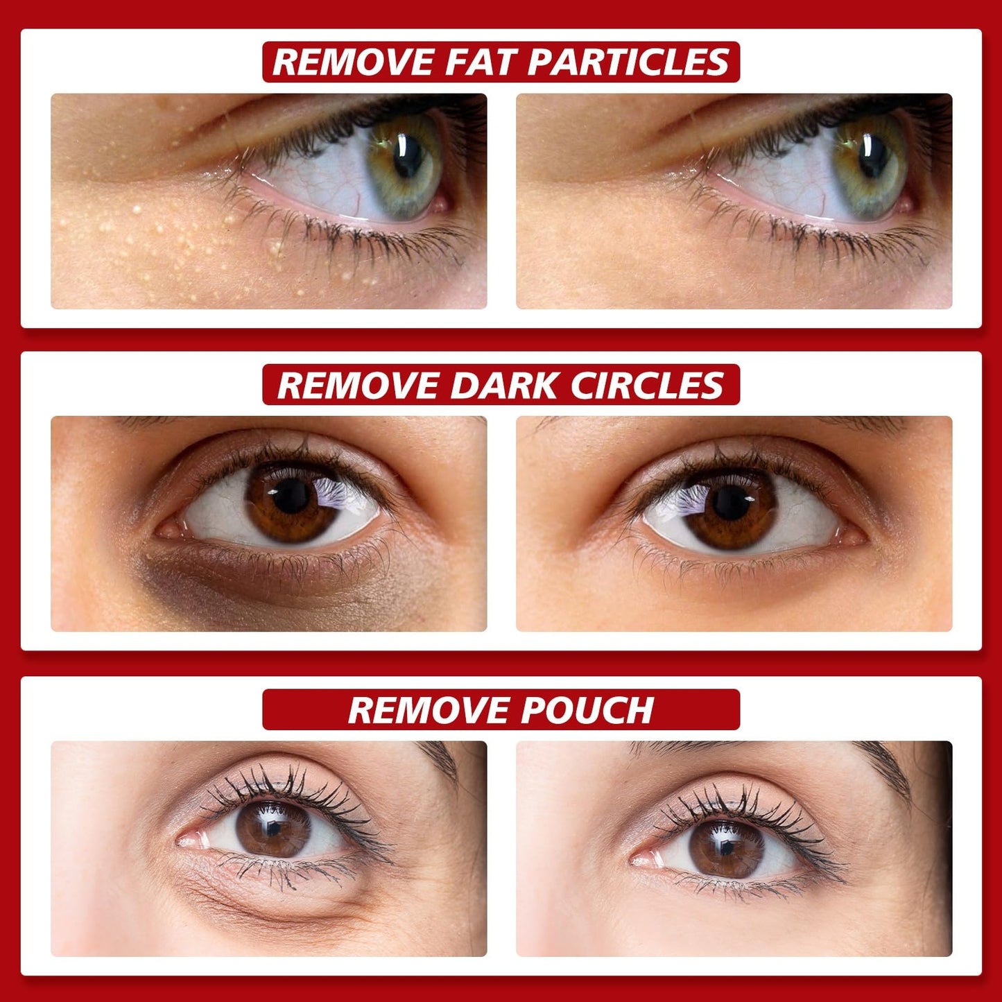 Fat Granules Removal Eye Serum,Anti-Aging & Anti-Wrinkles Under Eye Serum,Eye Ser-um for Dark Circles & Puffy Eyes,Tightening & Lifting Under Eye Serums,Dark Circle Eye Serums