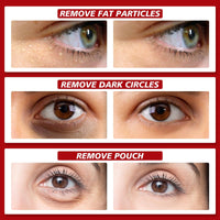 Fat Granules Removal Eye Serum,Anti-Aging & Anti-Wrinkles Under Eye Serum,Eye Ser-um for Dark Circles & Puffy Eyes,Tightening & Lifting Under Eye Serums,Dark Circle Eye Serums