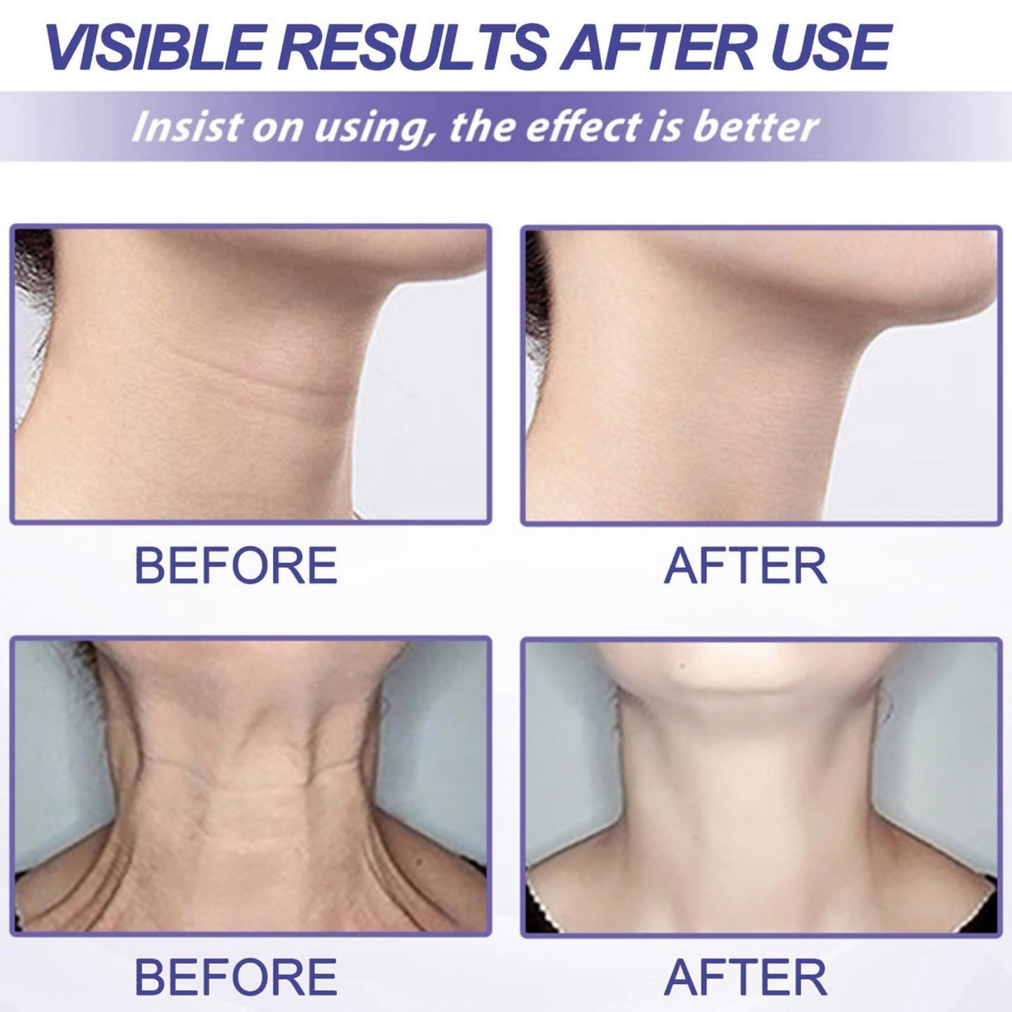 Joro/ndy Anti-Wrinkle Skin Cream for Remove Wrinkles,Skin Firming Face Cream,Skin Tightening Cream,Instant Tightening Face Cream,Skin Tightener Anti Wrinkle Firming Cre/am,Hydrating Facial Moisturizer