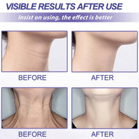 Joro/ndy Anti-Wrinkle Skin Cream for Remove Wrinkles,Skin Firming Face Cream,Skin Tightening Cream,Instant Tightening Face Cream,Skin Tightener Anti Wrinkle Firming Cre/am,Hydrating Facial Moisturizer