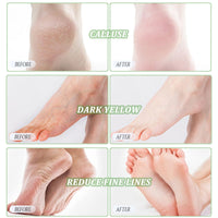 CGBOOM 3 Pack Foot Peel Mask Exfoliating Foot Mask Feet Peeling Socks Foot SPA Treatment for Baby Soft Feet Hard Dead Skin Remover Callus Repair Rough Cracked Heels (Tea Tree)