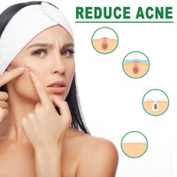 Siyinzu Dark Spot Remover Cream for Face & Body,Anti Aging Fac/e Cream,Dark Spot Remover,Freckle Removel Cre/am,Age Spot Remover for F/ace,Dark Spot Corrector Firming Fa/ce Moisturiser,Moisturiser Face Women