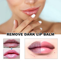 Ruojiar 2PCS Ginger Lip Lightening for Dark Lips,Lip Balm Lips Pink Bleaching Cream Balm,Fast Moisturizing Lightening Lip Balm,Lip Salve for Chapped Lips,Lip Moisturizer,Daily Lip Balm,Brightening Cream Blam