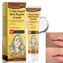 SingHao 7-Day Rapid Skin Repair Cream,Be/e Ve/nom S/kin C/ream,Sk/in Care Cream,Dark Spot Remover,Anti Wrinkle Face Cr/eam,Anti Aging Face Cre/am,Freckle Removal Crea/m,Lightening Cream,Lifting & Repairing