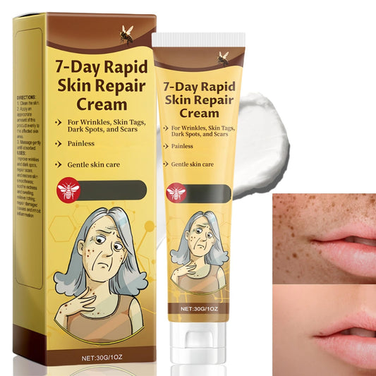 SingHao 7-Day Rapid Skin Repair Cream,Be/e Ve/nom S/kin C/ream,Sk/in Care Cream,Dark Spot Remover,Anti Wrinkle Face Cr/eam,Anti Aging Face Cre/am,Freckle Removal Crea/m,Lightening Cream,Lifting & Repairing