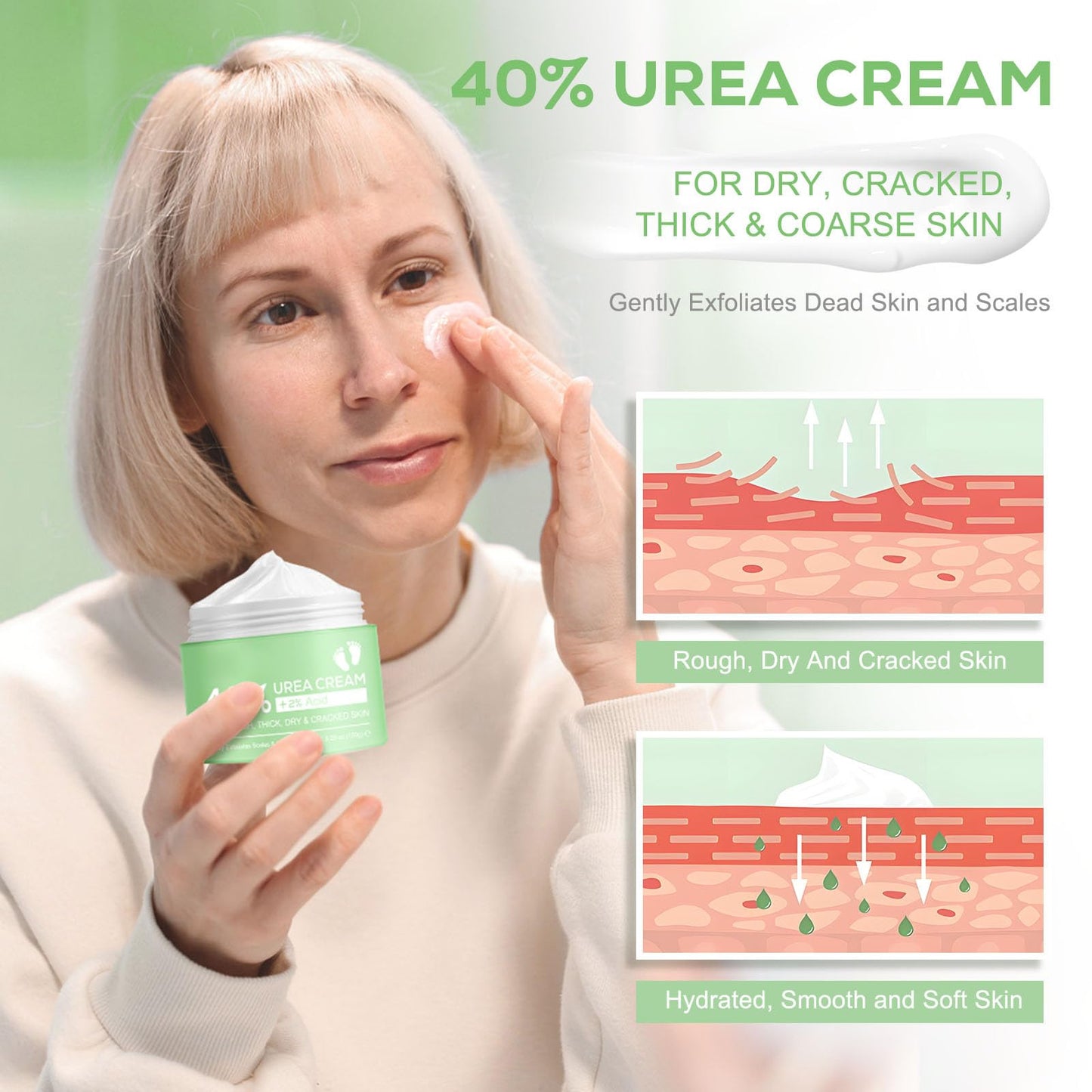 Urea Cream 40 Percent, Urea Foot & Hand Cream for Dry Cracked, 40 per Urea Lotion for Feet- 150g