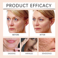 SingHao Firming Serum Stick,Collagen Peptides Firming Serum Stick,Retinol Facial Firming Stick,Skin Tightening Cream for Face,Neck and Face Serum Care Stick,Bee Venom Cream,Neck Firming Cre/am for Women