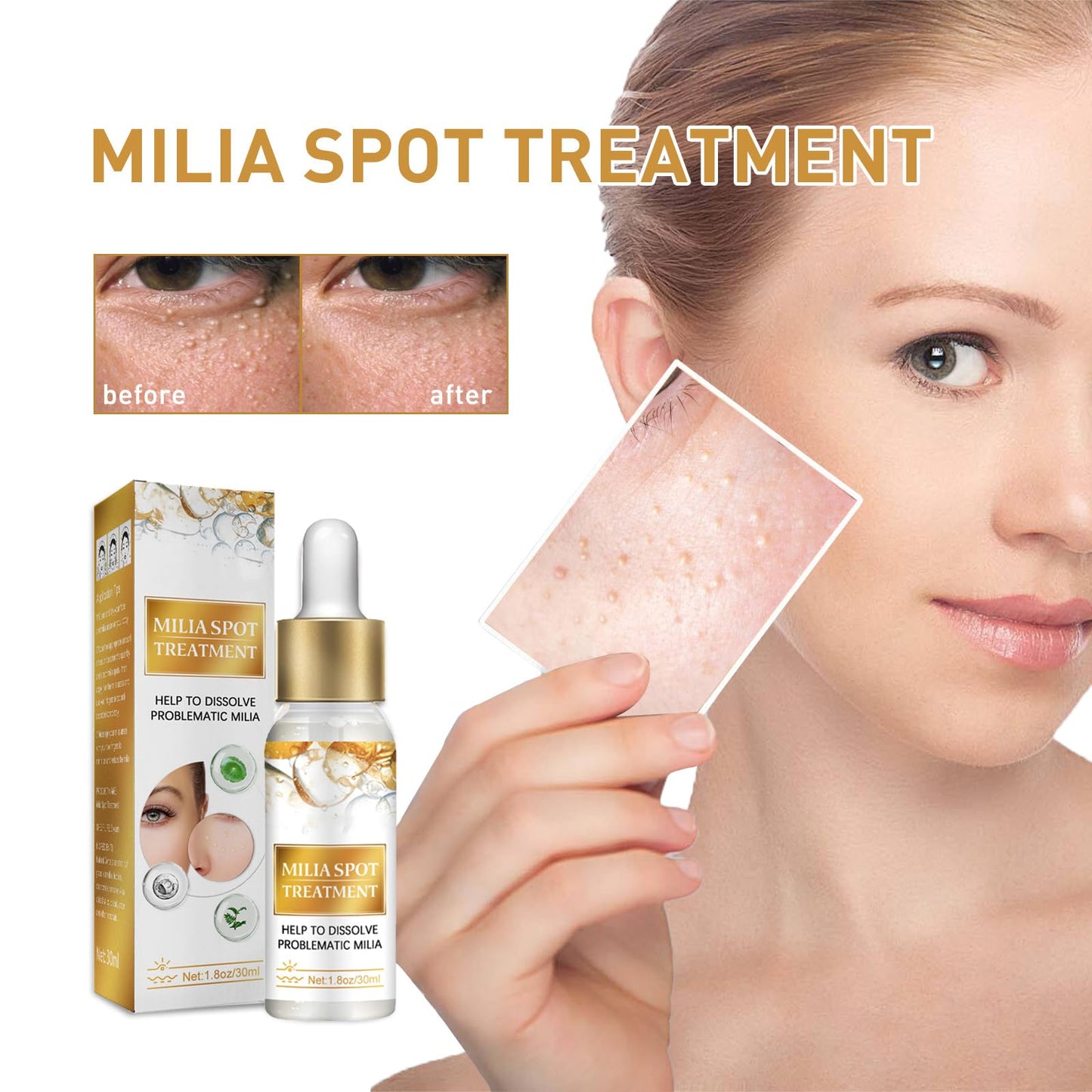 GNAUMORE Milia Spot Serum for Face,Milia Treatment under Eye,Eye Serum for Dark Circles and Puffy Eyes,Fat Granule Clearing Skin Serums,Even and Radiant Skin Generic,30ml