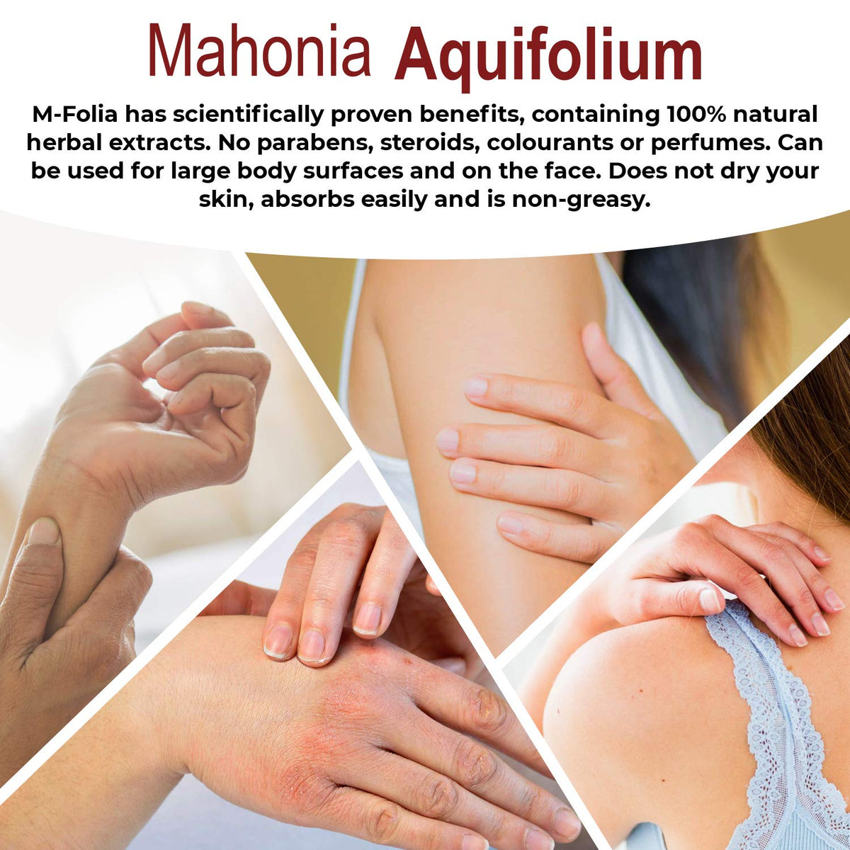M-Folia M-FOLIA Psoriasis Cream. A Rich, Non-Greasy Skin Cream Specially formulated for Treating Psoriasis, Eczema & Related Dry Skin Conditions