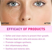 GNAUMORE Milia Spot Serum for Face,Milia Treatment under Eye,Eye Serum for Dark Circles and Puffy Eyes,Fat Granule Clearing Skin Serums,Even and Radiant Skin Generic,30ml