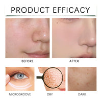 QinZiEn Skips The Line Instant Wrinkle Eraser Face Cream,Face Tightening Cream,Face Moisturiser,Anti Wrinkle F/ace Cr/eam,Anti Aging F/ace C/ream,Night C/ream for Women Anti Aging,Tightening Sagging Skin