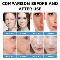 Cureluxe Ultra B5 Sooth and Repair Face Serum Cream,B5 Repairing Balm for Face,Skin Barrier Repair Cream for Dry & Irritated Skin,Multi-Purpose Deep Hydration Serum Face Cream for Face&Body - 2PCS