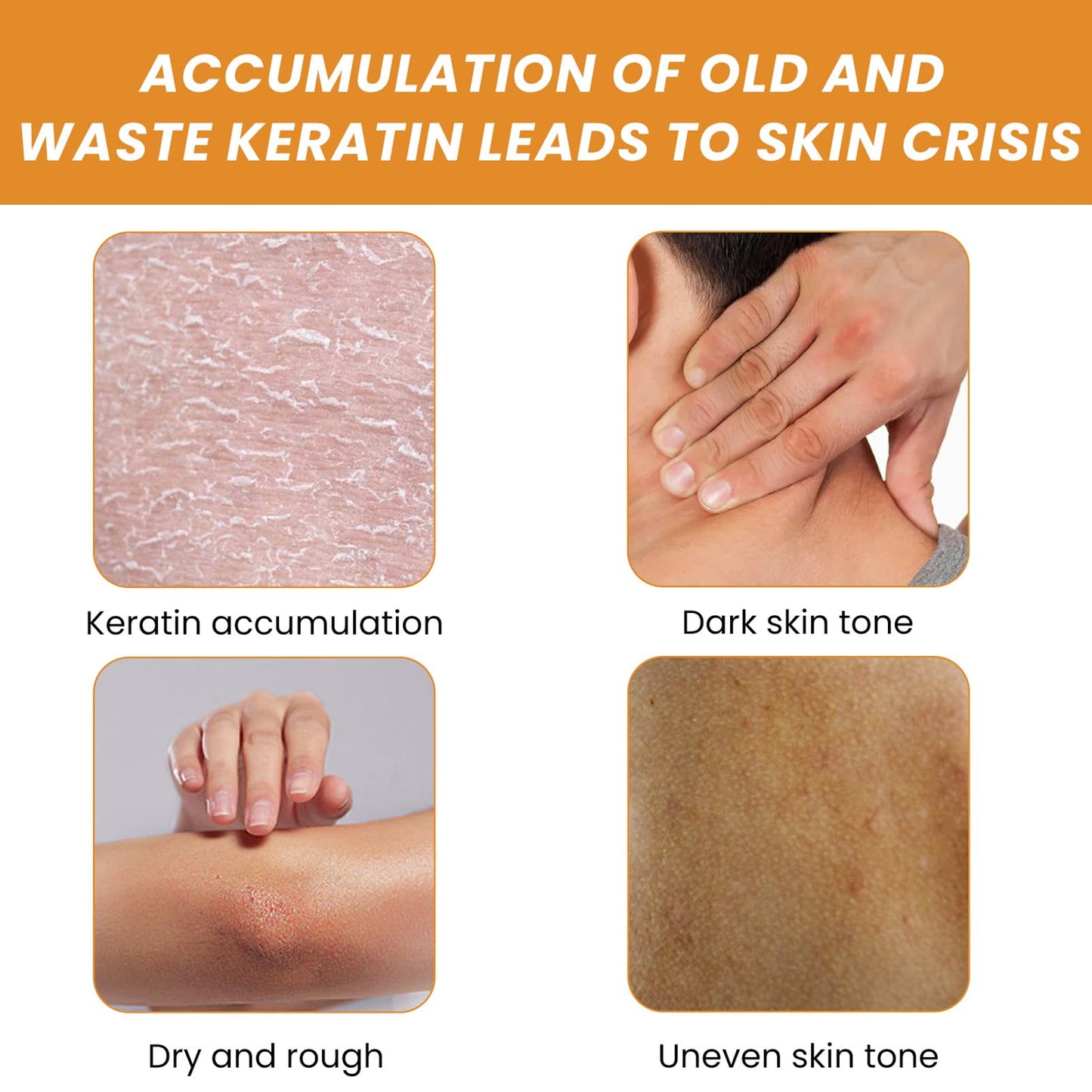 DMQ Orange Face Scrub Exfoliator,Acne Exfoliating Face Scrub,Pore Facial Scrub,Remove Blackhead & Smooth Skin Tone,Face Scrub for Men & Women,Vitamin C Body Scrub for Dull Skin,Arm & Back & Leg-50g