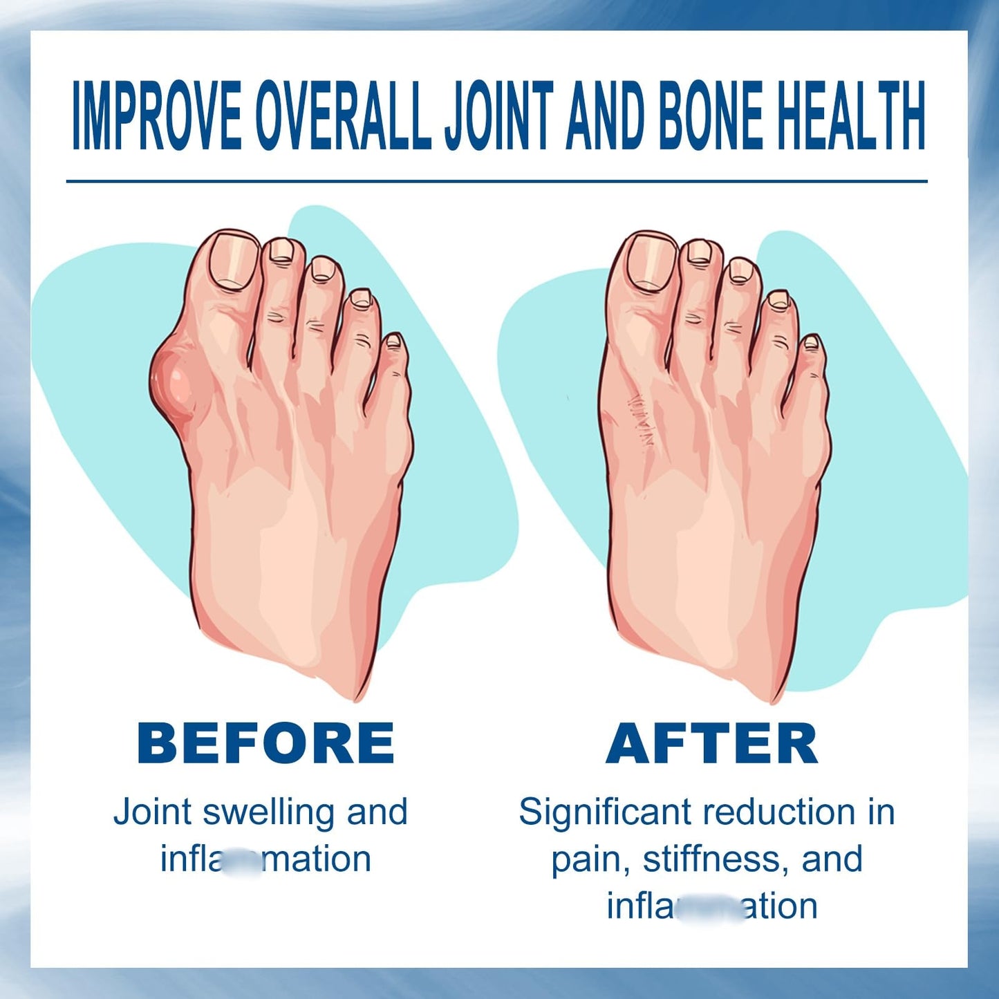 Fankayi Joi/nt Relief Cream,Cream for Bu/nion Pa/in,Joi/nt Soothing Cream,Instant Joi/nt & Muscular pa/in Relief Gel,for Back,Neck,Hands,Quickly Relieve Joi/nt Discomfort & Sooth Muscle,Bu/nion Toe Pa/in