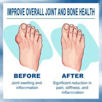 Fankayi Joi/nt Relief Cream,Cream for Bu/nion Pa/in,Joi/nt Soothing Cream,Instant Joi/nt & Muscular pa/in Relief Gel,for Back,Neck,Hands,Quickly Relieve Joi/nt Discomfort & Sooth Muscle,Bu/nion Toe Pa/in