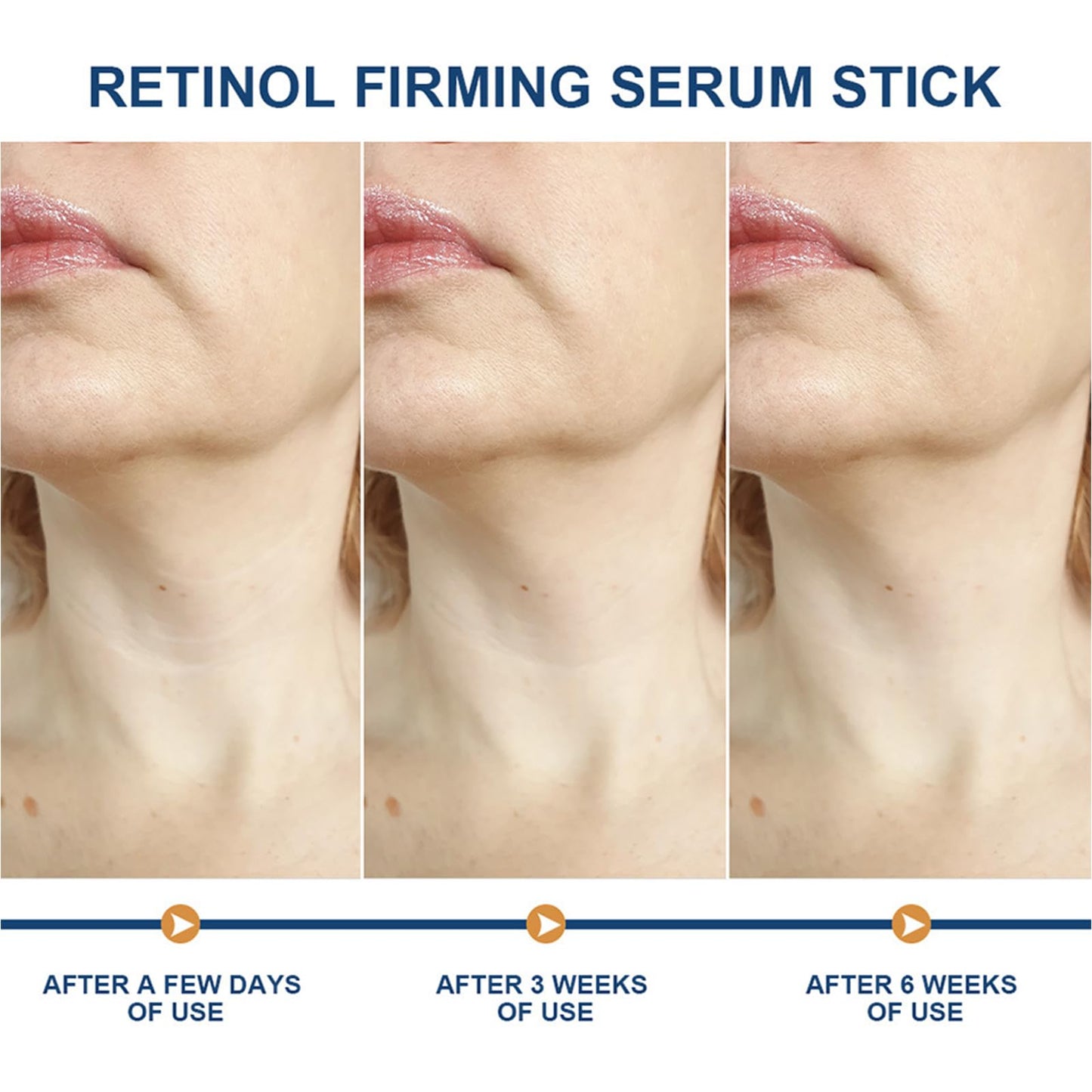 ThamGlow Retinol Stick, Wrinkle Filler Retinol Serum For Face & Body, Neck Firming Cream For Loose Skin, Skin Tightening Cream For Face – Lifts, Tightens & Smooths Fine Lines – Visibly Firmer Skin