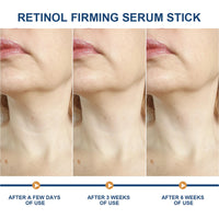 ThamGlow Retinol Stick, Wrinkle Filler Retinol Serum For Face & Body, Neck Firming Cream For Loose Skin, Skin Tightening Cream For Face – Lifts, Tightens & Smooths Fine Lines – Visibly Firmer Skin