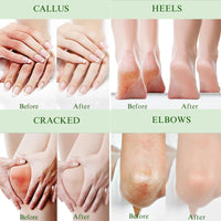 IZBEAUVO Peppermint Foot Cream for Cracked Heels and Dry Skin – Deep Moisturising athletes foot treatment with Shea Butter & Coconut Oil – Cooling Relief for Athletes Foot, Calluses & Hard Skin – 114G