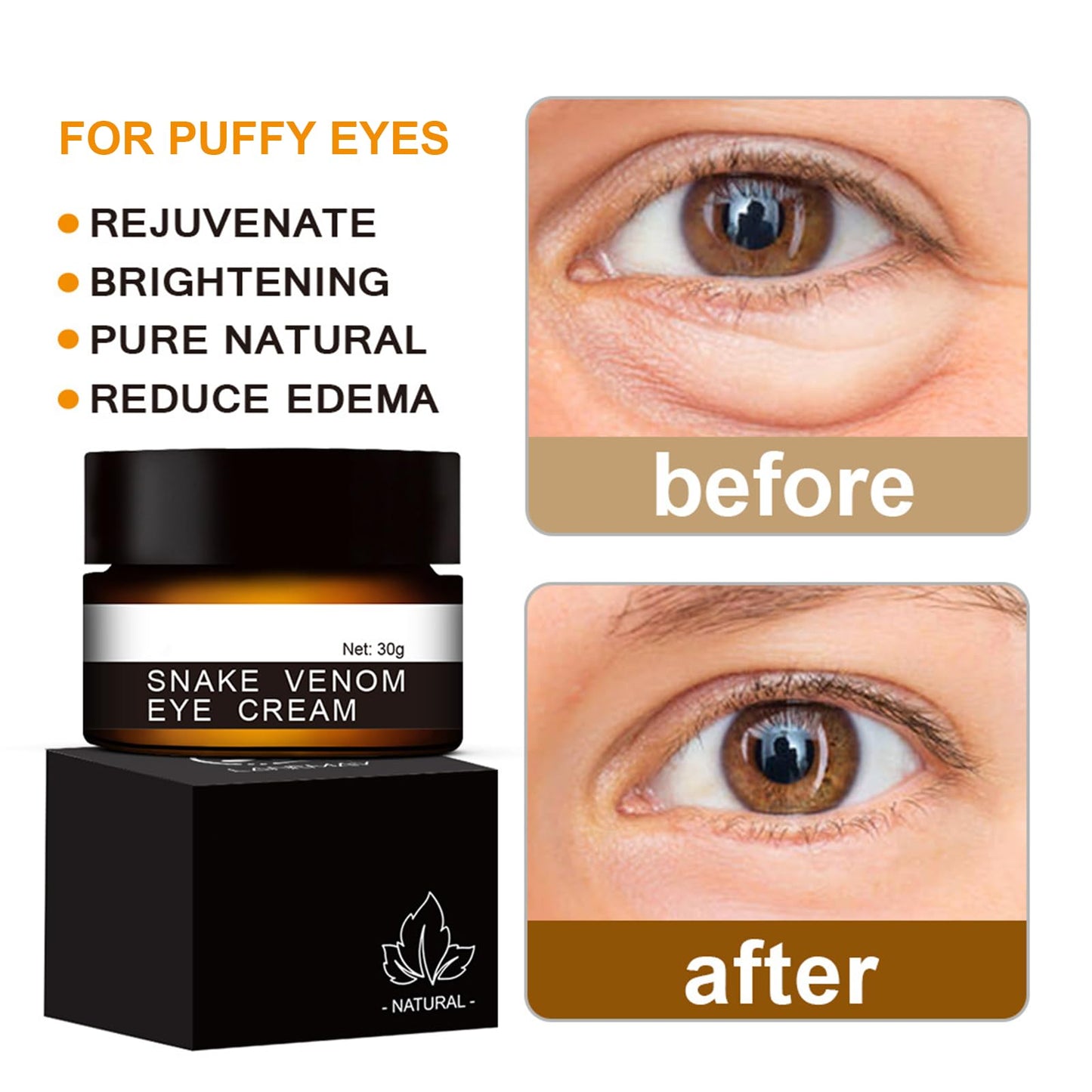 Snake Venom Eye Cream - Anti Wrinkle Eye Cream For Puffiness + Wrinkles, Brightening Under Eye Cream, Diminishing Deep Wrinkles Dark Circle Eye Cream, Eye Bag Treatment For Men And Women, 30g