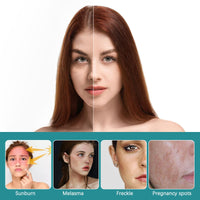 Nadiaen 2 Pcs Dark Spot Remover for Face,Age Spot Remover Hyperpigmentation Treatment-Sun Spots and Melasma Treatment Cream for Face, Pigmentation Freckle Removal Cream