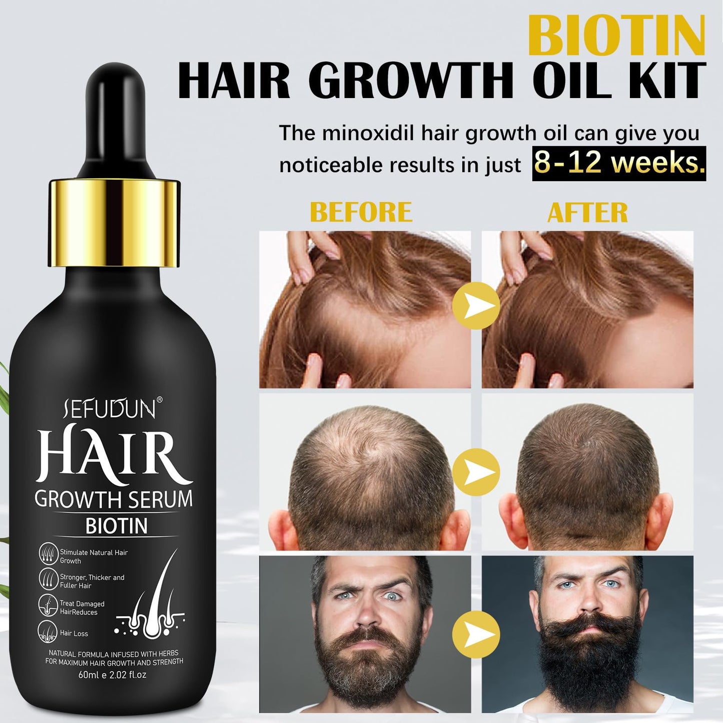 Hair Growth Serum with Biotin for Women, Beard & Hair Growth Oil for Loss Treatment, Hair Thinning, Natural Hair Growth Longer Fuller Healthier Hair, with 0.25mm Roller