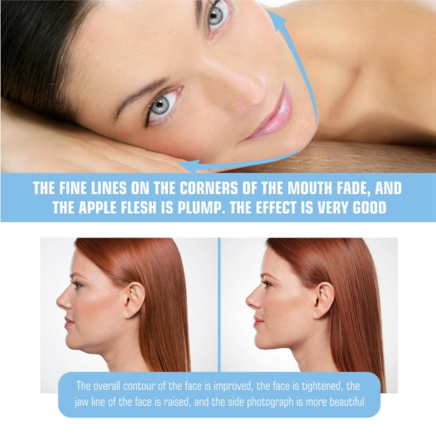Xinyig 5pcs Bloskin Lift Mask,Double Chin Mask,Face Lift Mask,Double-Chin Reducer Collagen Mask,Face Lifting Mask,V Line Lifting Mask,V Shape Face Tape Mask,V Lifting Chin Up Patch,Skin Tightening Mask