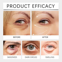 Lutein Eye Essence Oil,L/utein Anti-Wrinkle E/ssence O/il,E/ye Serum for Lines and Wrinkles,VC Lu/tein Essential Oil,Lutein Rollerball Essence,Under E/ye Cream Dark Circles,Eye Bags Remover Women