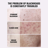 ISBEAUSOLS Blackhead Remover Mask-Salicylic Acid Nose Strips-Black Head Remover for Face-Nose Pore Strips for Remove Blackheads,Acne and Pores-60Pcs Nose Patches-Gentle Pore Strips with Vitamine C