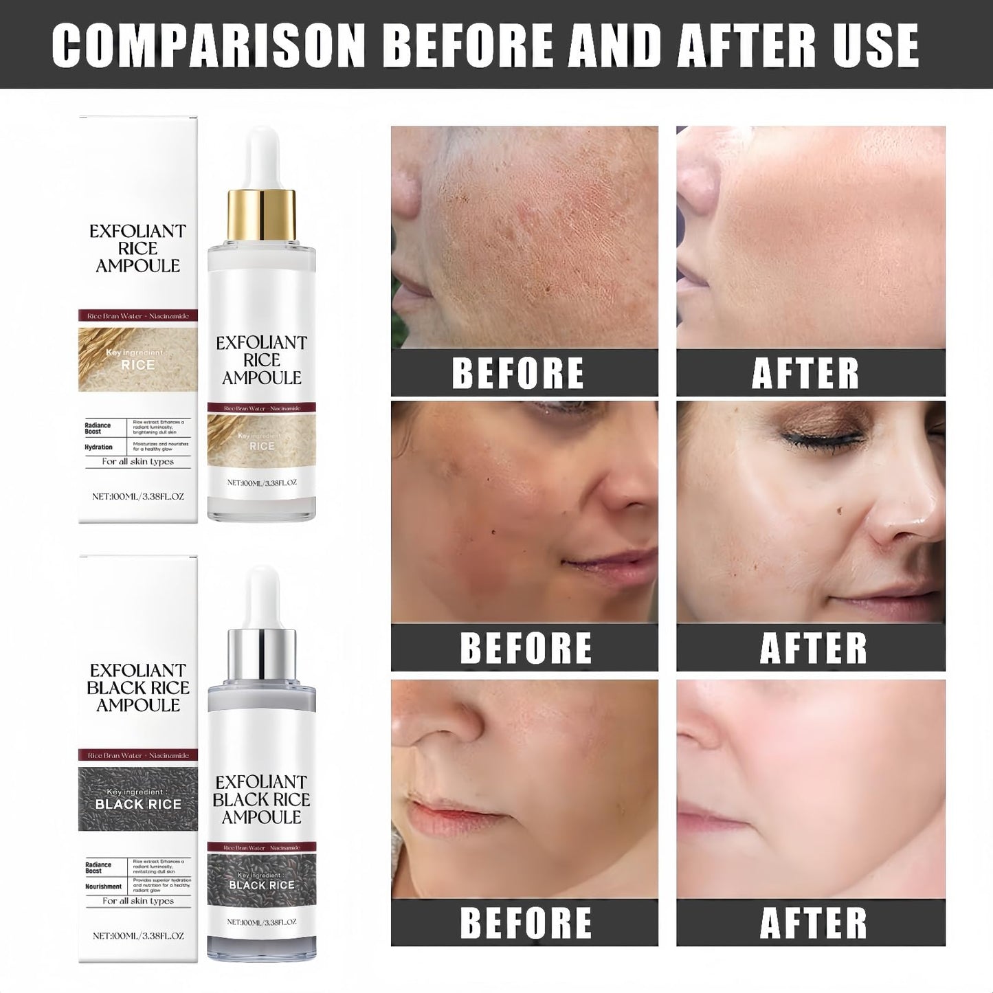 AINxtolm 2pcs Peel Shot Glow Rice Ampoule,Rice Ampoule Duo,Black R-ice Peeling A-mpoule,R-ice Exfoliant,Black and White Ri-ce Face Exfoliantor,Peel Shot Glow White Ri-ce A-mpoule,Face Scrub,Toner for F-ace