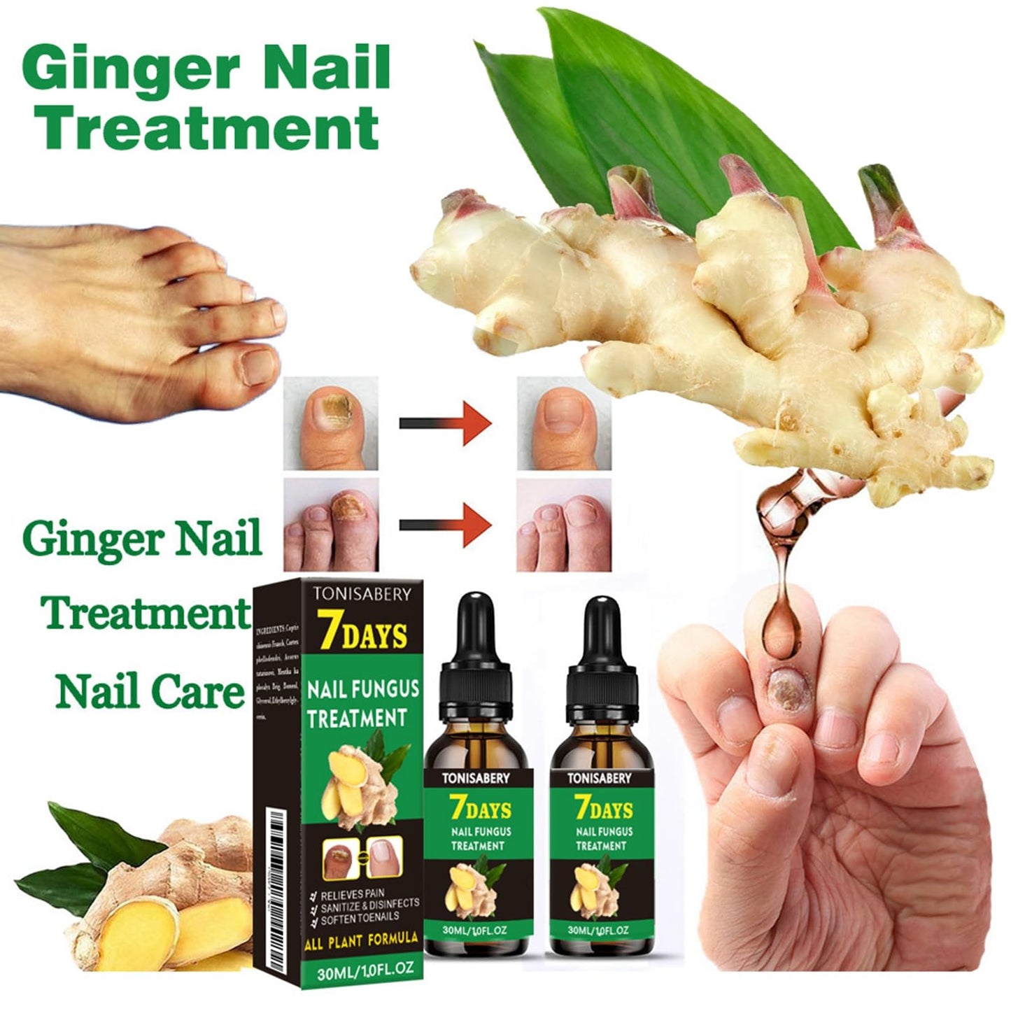 Ginger Nail Treatment Nail Support Nail Care - Ginger Nail Growth Serum, 7 Days Nail Treatment, Ginger Cuticle Care Oil for Nails, Nail Strengthener For Damaged Nails, Fungal Nail Treatment
