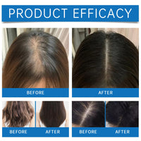 AuraAnge 2PCS Scalp Cooling Hair Ampoule, Scalp Serum & Hair Growth Serum for Men & Women – Top-of-Head Protector with Roller, Non-Greasy, Improves Shine & Cleans Surface, 20g